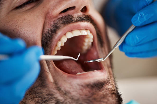 Best Cracked Tooth Emergency Dentist  in Verona, VA
