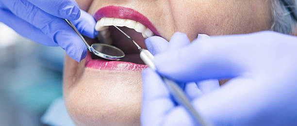 Best Dentist for Tooth Abscess  in Verona, VA